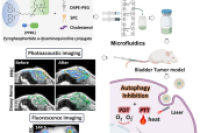 微流控合成多功能纳米颗粒，为膀胱癌双模态影像引导光疗提供高效平台